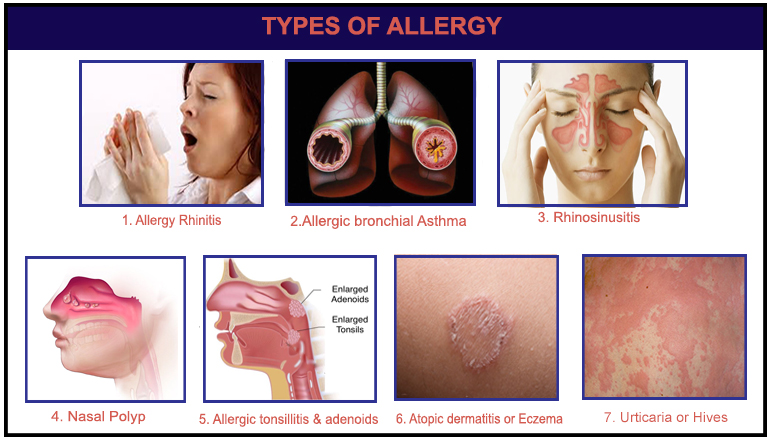 type of allergy